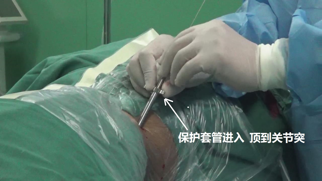 7-保护套管进入.jpg